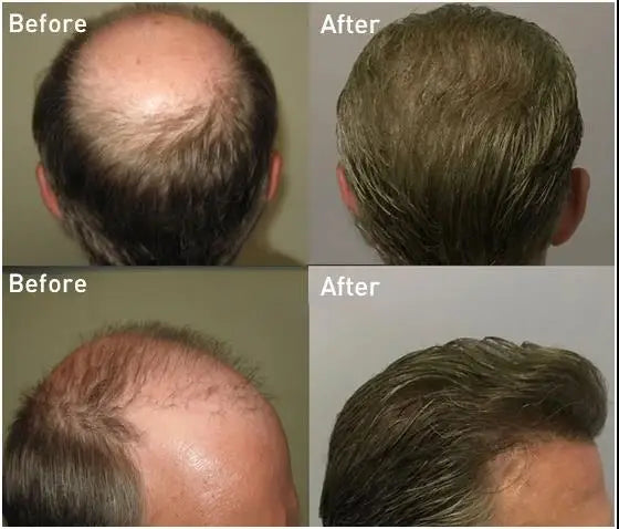 I Skin Hair Prosthesis 0.12 - 0.14 mm Indian Human Hair Multiple Sizes Toupee Men Fashion Wig Male