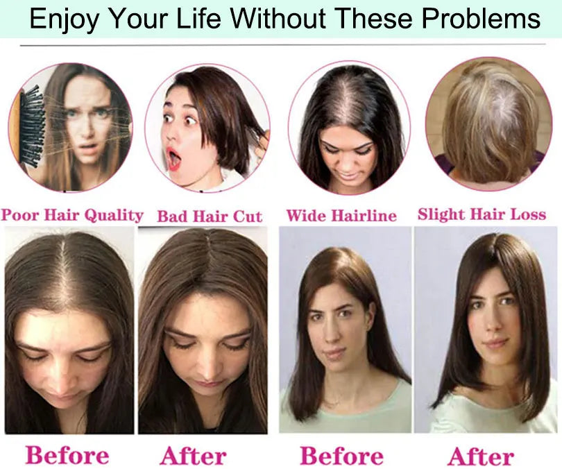 6x6 inch Injected Silk Skin Base Human Hair Women Topper Virgin European Hair Toupee Clips In Hairpiece Natural Scalp Top