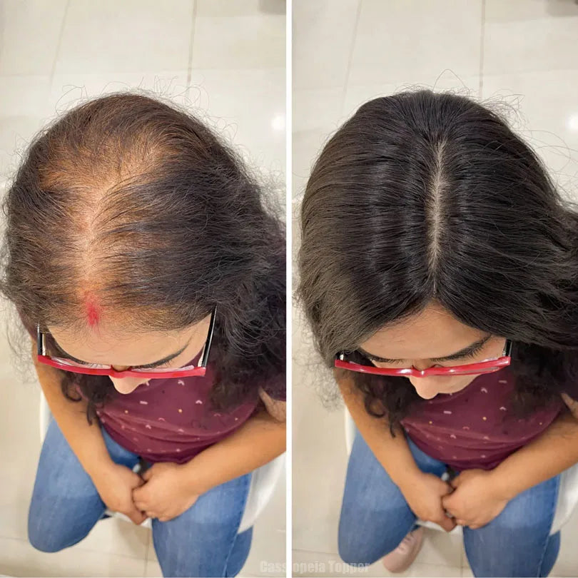 6x6 inch Injected Silk Skin Base Human Hair Women Topper Virgin European Hair Toupee Clips In Hairpiece Natural Scalp Top